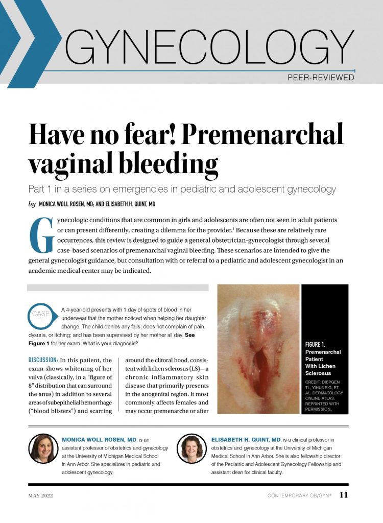 Have no fear! Premenarchal vaginal bleeding