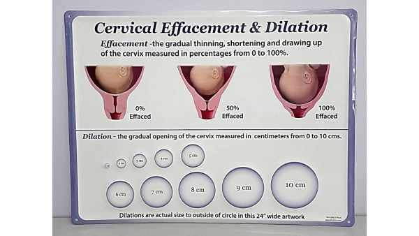 Dilation and Cervical Effacement Board - Image 2