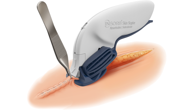 INSORB Subcuticular Skin Stapler
